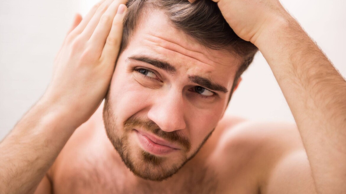 Going Bald Too Young? Top Tips From The Experts!